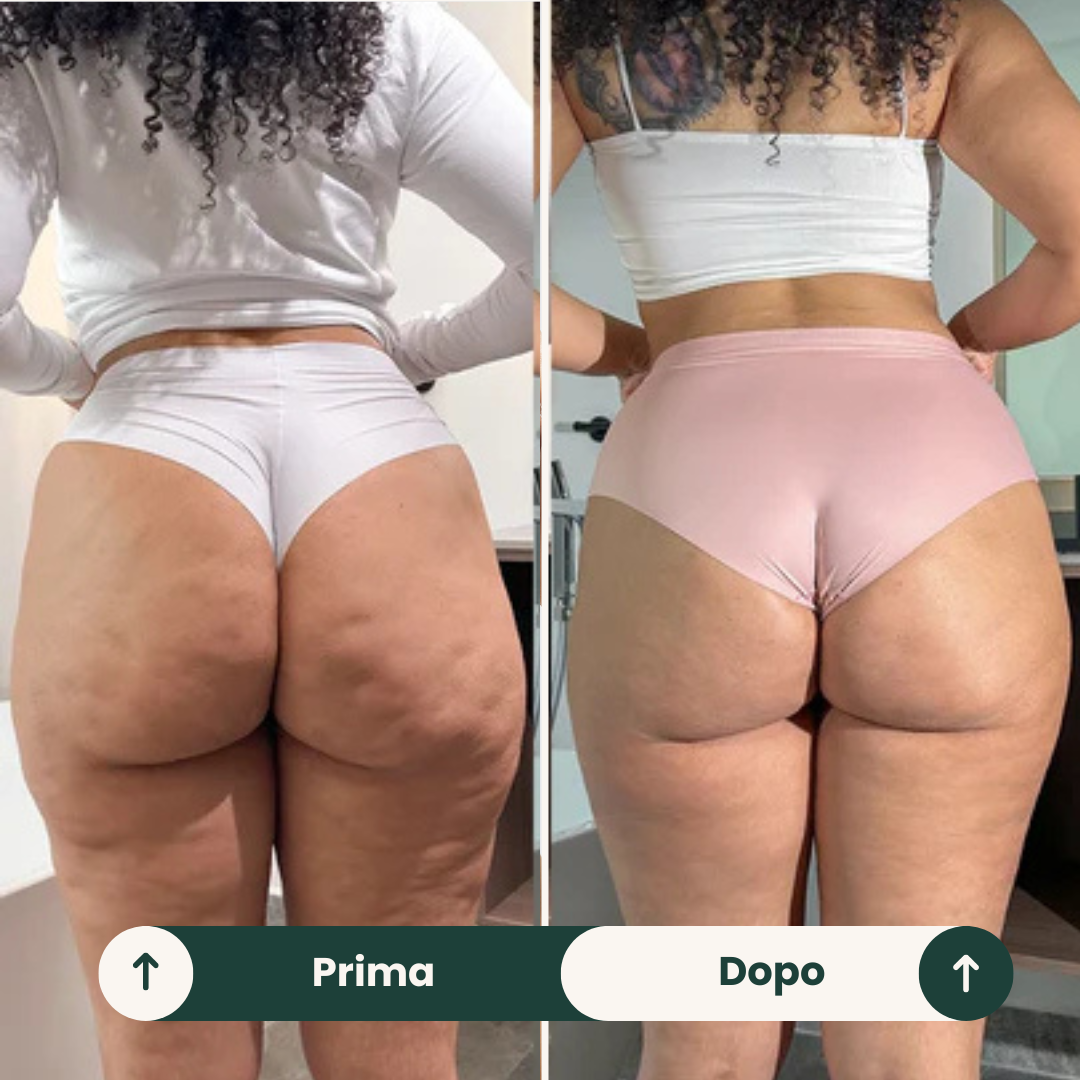 SculpiFlex™ - Dispositivo Rimodellante Corpo 3 in 1
